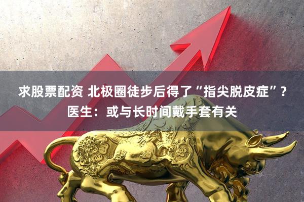 求股票配资 北极圈徒步后得了“指尖脱皮症”？医生：或与长时间戴手套有关